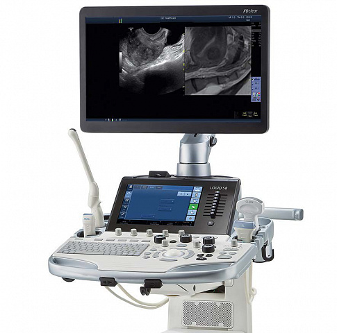 GE Healthcare Logiq S8