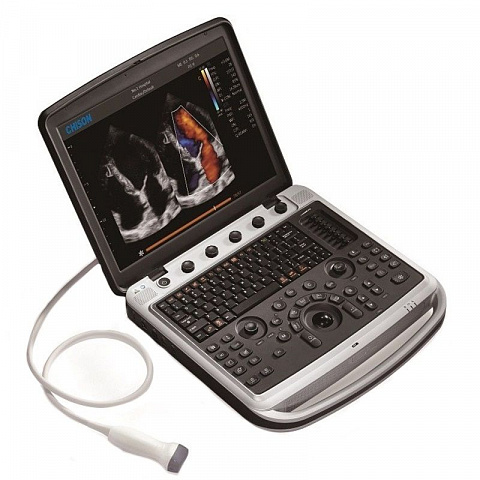 Chison SonoTouch 80 Expert