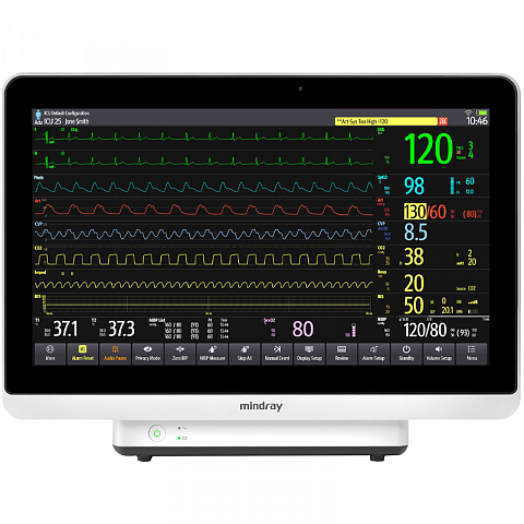 Mindray BeneVision N19