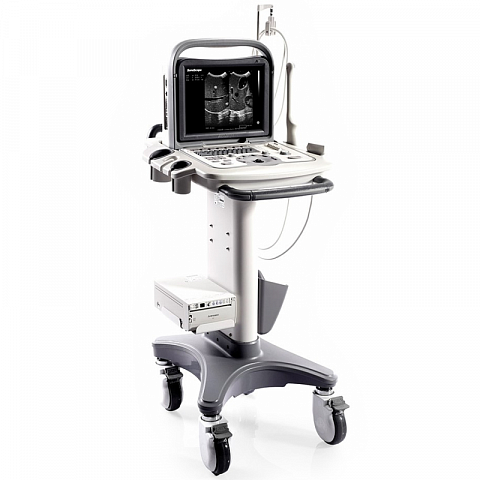 Sonoscape A6V