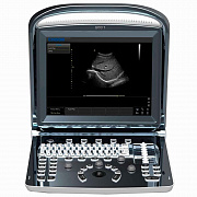 Chison SonoTouch 10