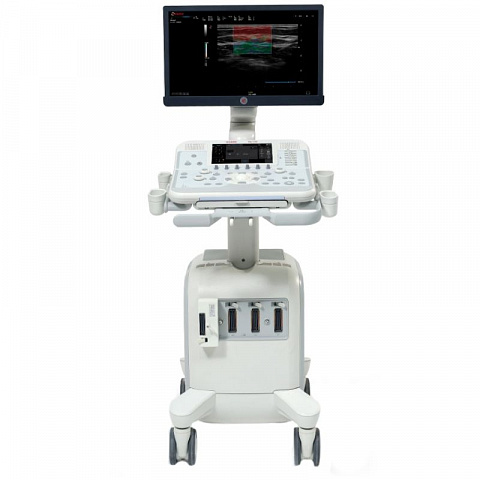 Esaote MyLab x6