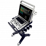 Chison SonoTouch 60