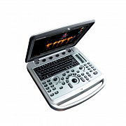 Chison SonoBook 6