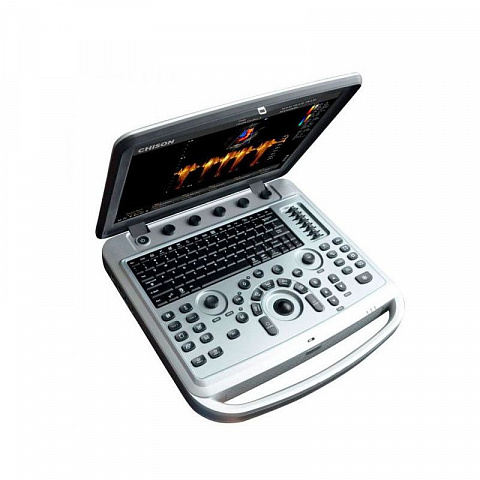 Chison SonoBook 6