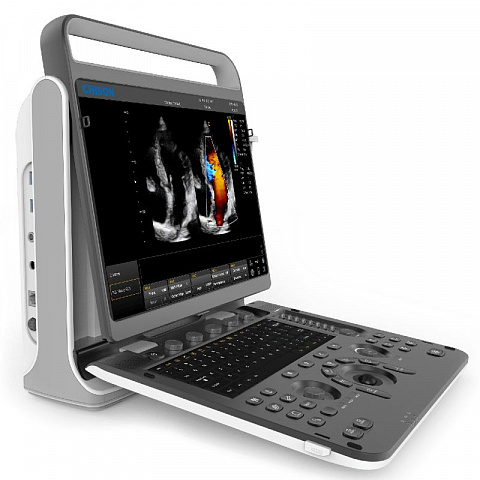 Chison SonoTouch 60 Pro