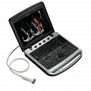 Chison SonoBook 9