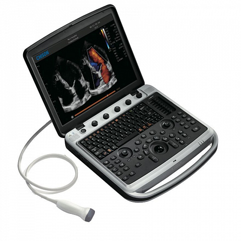 Chison SonoBook 9